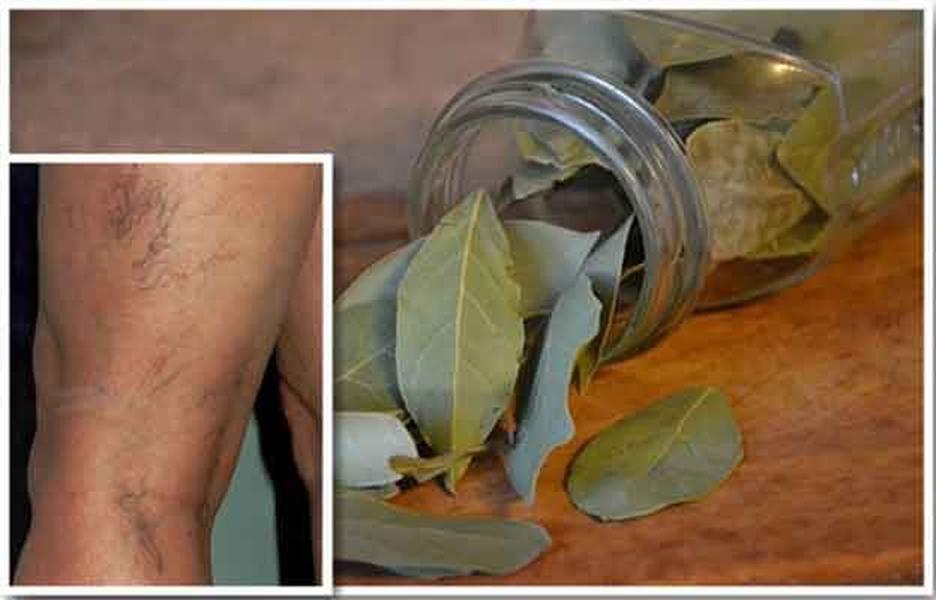 Foi de dafin în apă fierbinte – Tratament pentru durerile de la nivelul picioarelor